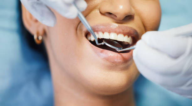 Best Emergency Dentist for Lost Fillings or Crowns in Port Isabel, TX